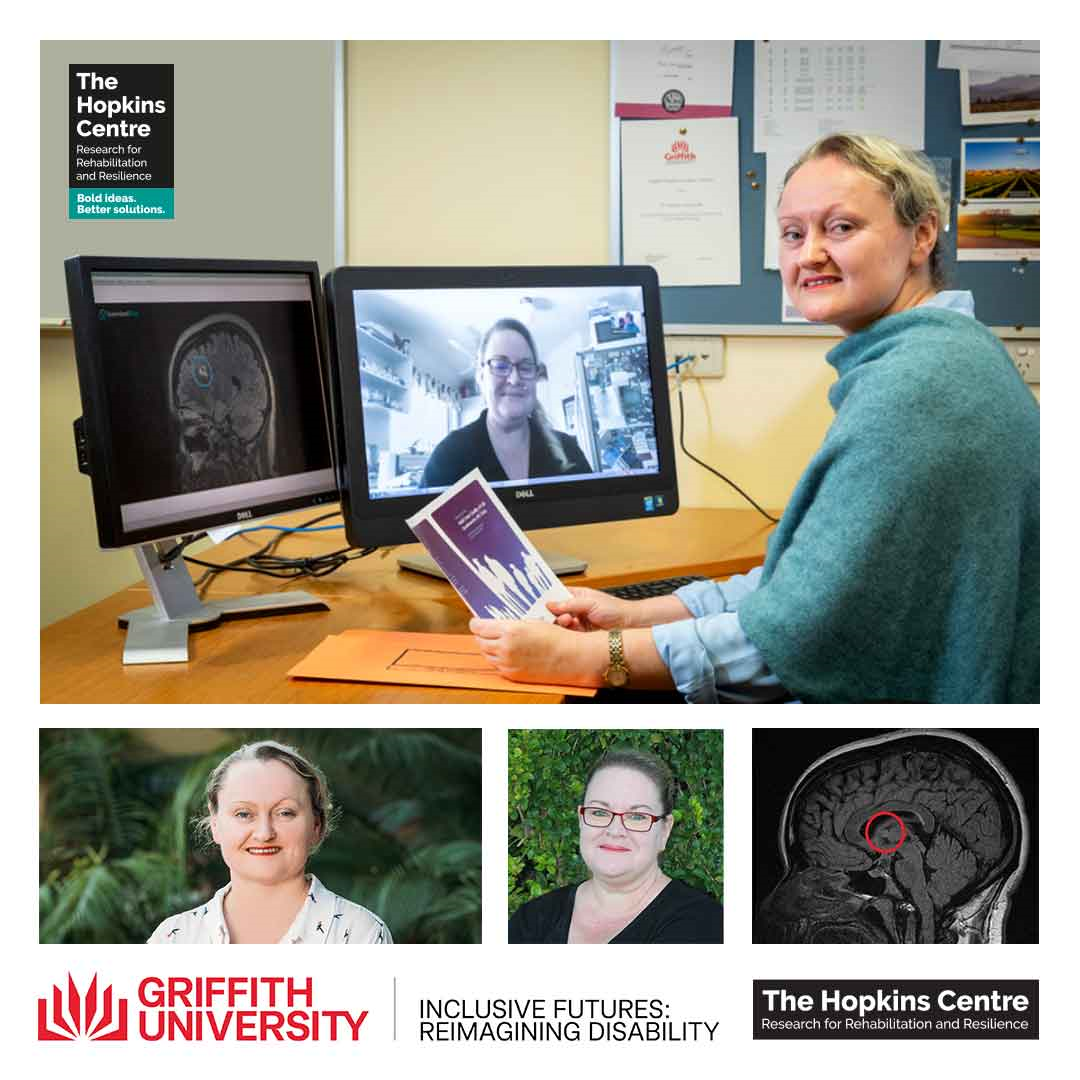 Large image of Tamara Ownsworth wearing a green jumpter sitting at a desk meeting with one screen showing Julia Robertson and the other screen showing Julia's brain scan. Three other images at the bottom of the tile include one profile photo of Tamara and another of Julia and a third image of Julia's brain scan.